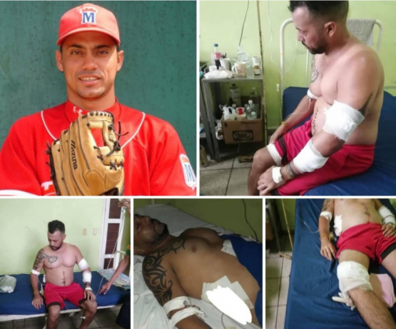 Asalto brutal contra ex Lanzador Cubano Maykel Hidalgo en Guanabo, La Habana.